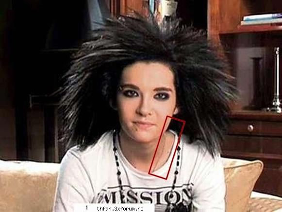 -Bill, after operation- - yo???....yo nu prea sunt noua....sau va referitzi - Bill